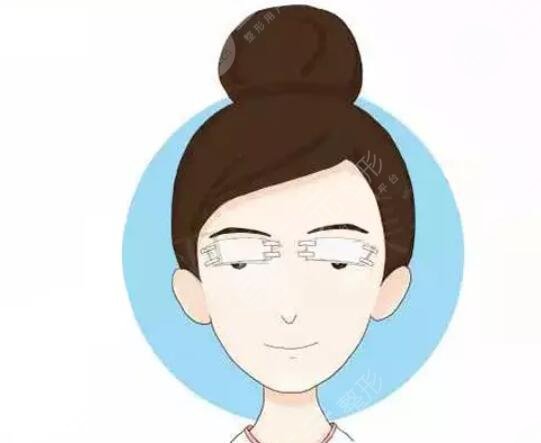 眼部整形價(jià)格