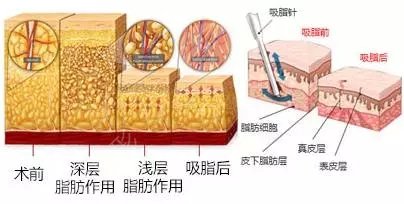 浙江榮軍醫(yī)院美容整形外科