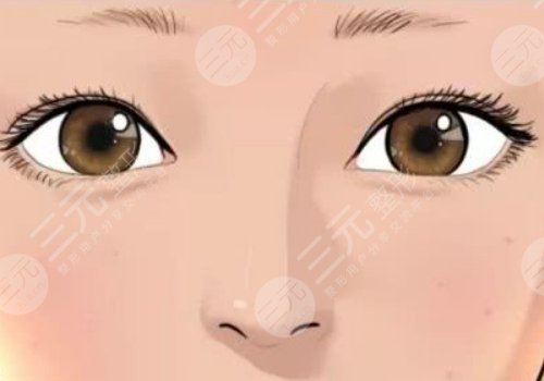 雙眼皮凹陷了怎么補救