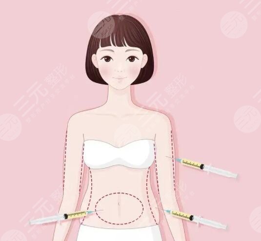 重慶醫(yī)科大學(xué)附屬第一醫(yī)院抽脂價(jià)格表