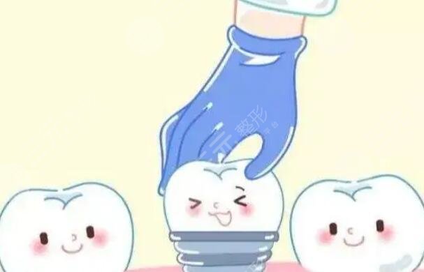 牙齒種植