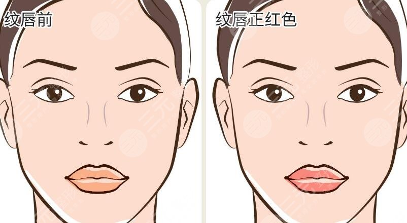 紋唇