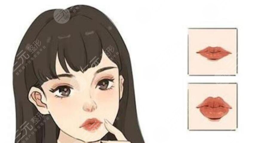 豐唇