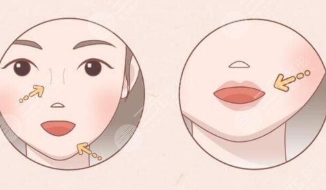 紋唇