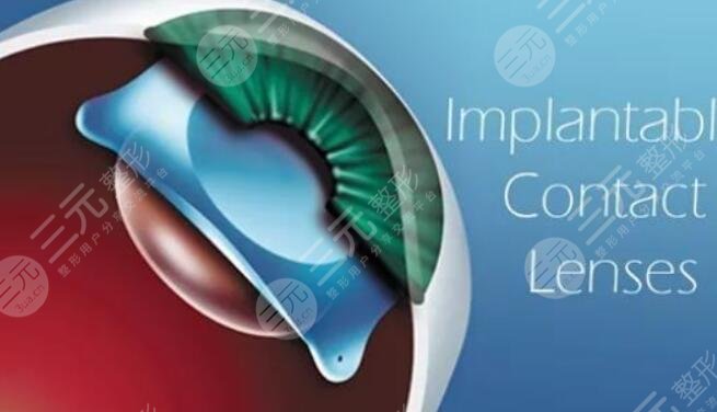 人工晶體植入矯正手術(shù)