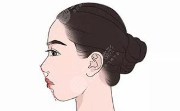 正頜
