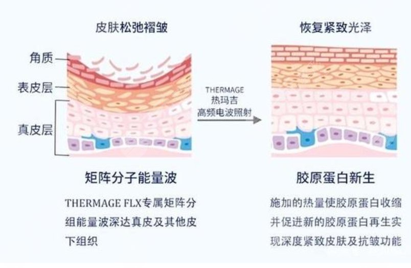 熱瑪吉