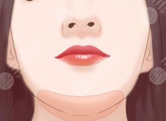 墊下巴
