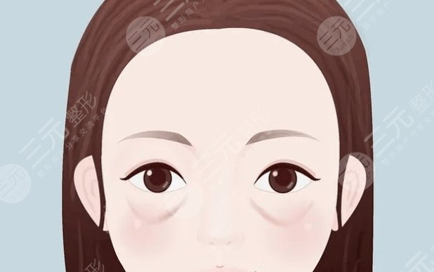 眼袋