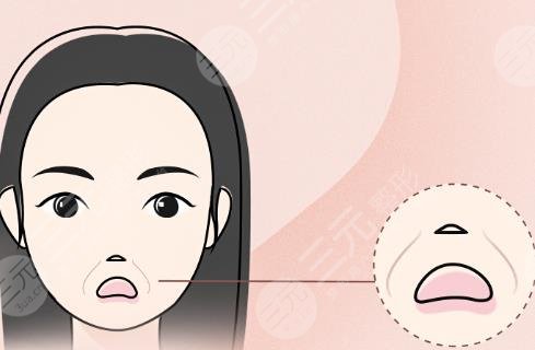法令紋