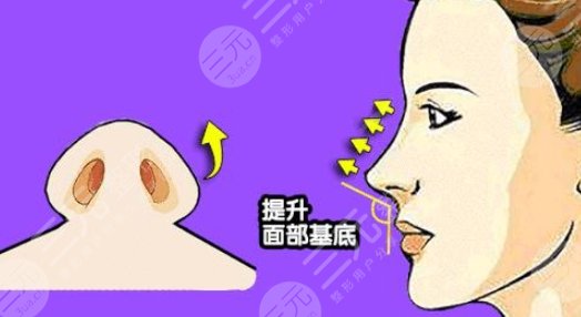 鼻基底