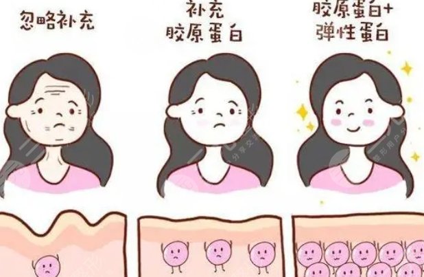 填充膠原蛋白