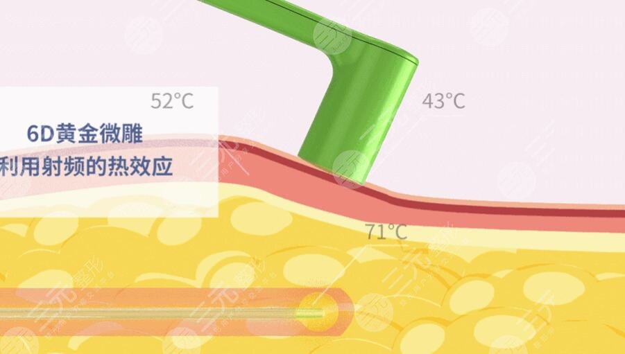 黃金微雕