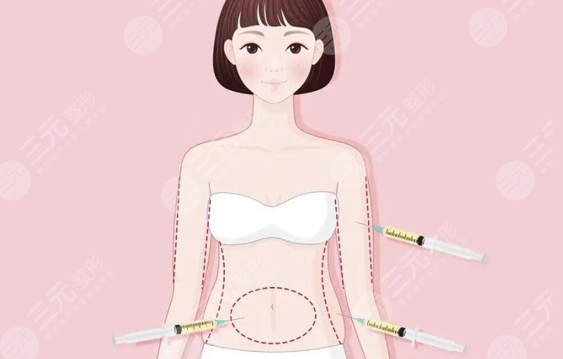 黃金微雕