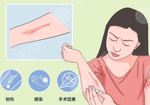 章一新疤痕怎么樣