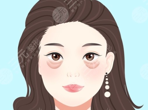 眼袋