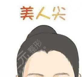 美人尖