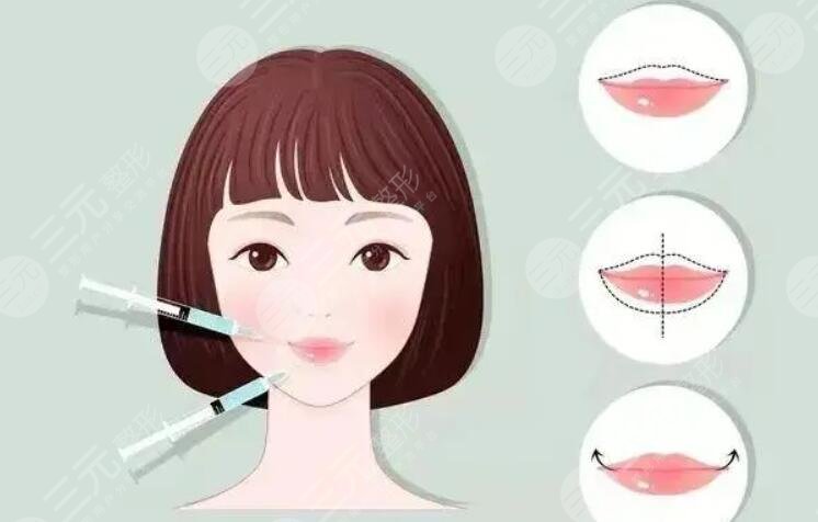 m唇