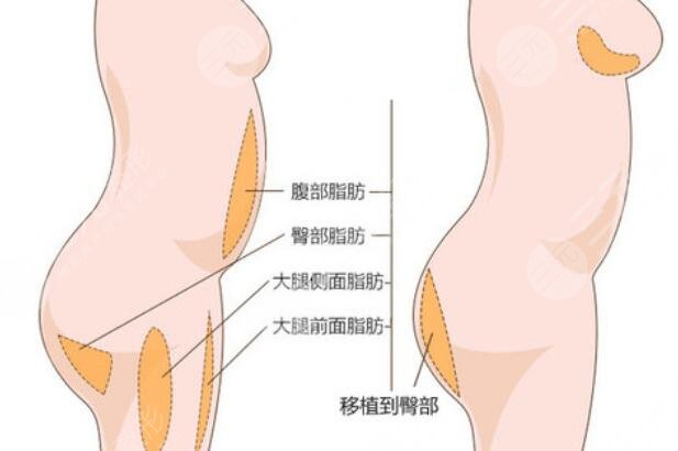 豐臀