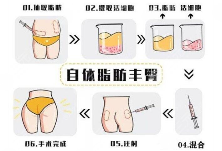 豐臀