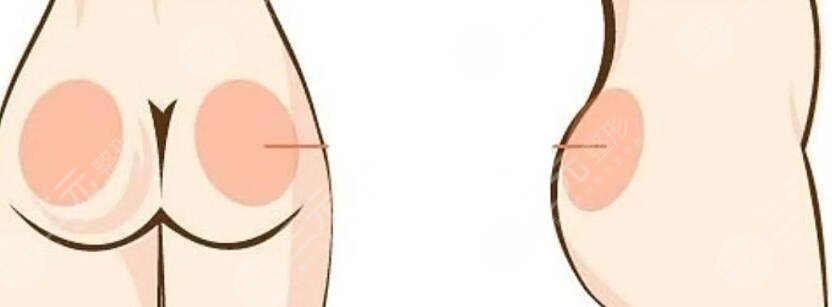 豐臀