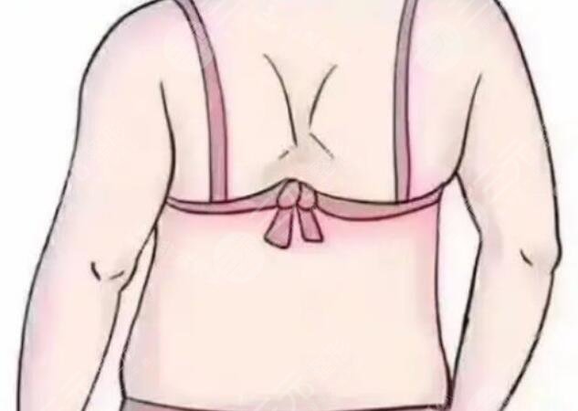 背部吸脂動(dòng)漫