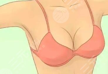 隆胸