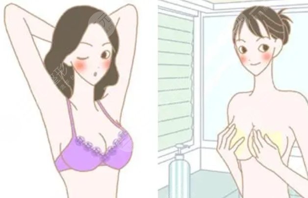 隆胸