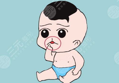 章建林做唇腭裂好嗎