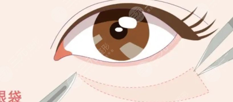 眼袋