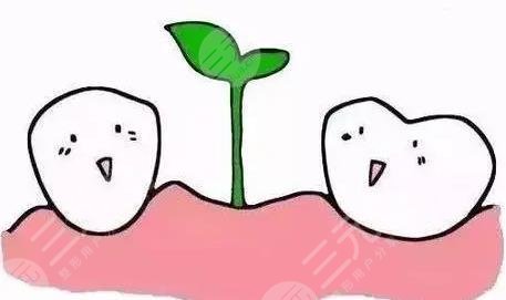 種植牙