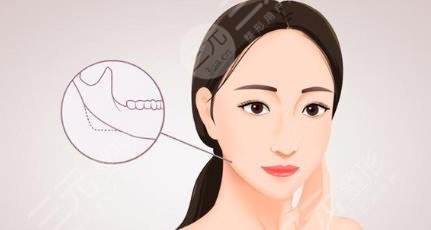 下頜角