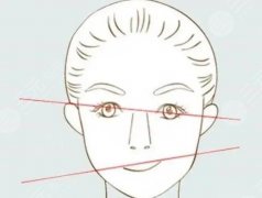 磨骨改臉型有后遺癥嗎？出現(xiàn)后遺癥該如何應(yīng)對(duì)？費(fèi)用參考