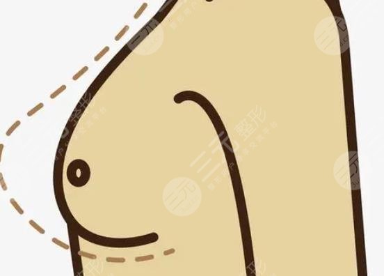 內(nèi)窺鏡隆胸