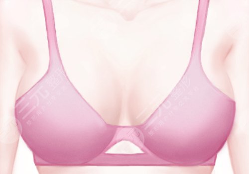 南昌二附院隆胸價格