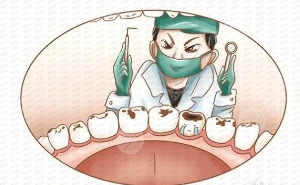 根管手術