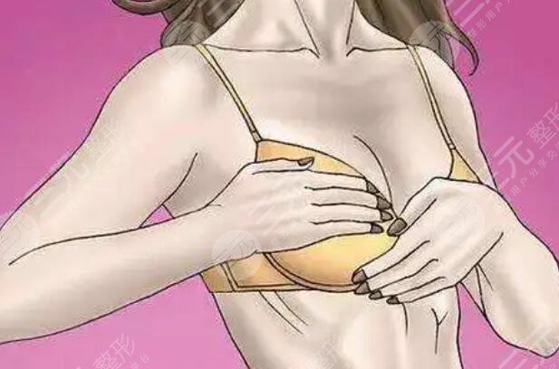 乳房下垂