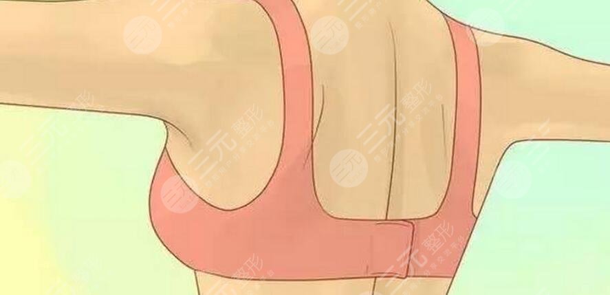 乳房下垂矯正