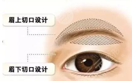 切眉