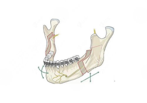 南昌二附院正頜多少錢(qián)