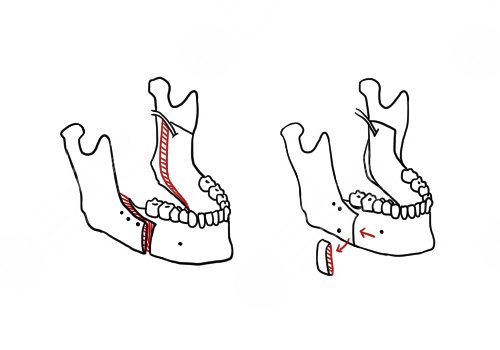 南昌二附院正頜多少錢(qián)