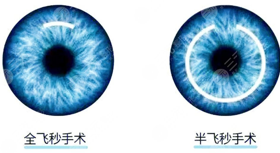 全飛秒