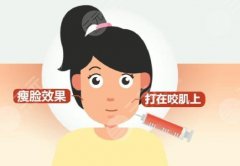 射頻溶脂瘦臉會(huì)反彈嗎？溶脂瘦臉的優(yōu)勢(shì)有哪些？