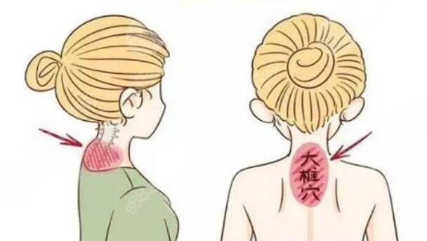 富貴包吸脂