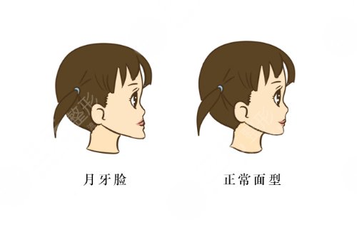 中山大學附屬口腔醫(yī)院做正頜手術怎么樣