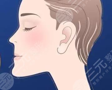 正頜手術(shù)
