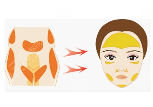 劉杰偉和萬(wàn)友望誰(shuí)技術(shù)好