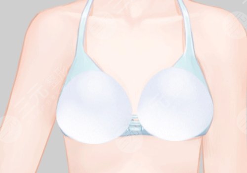 深圳富華隆胸怎么樣