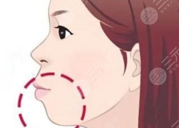 正頜