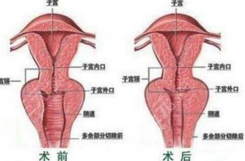 私密